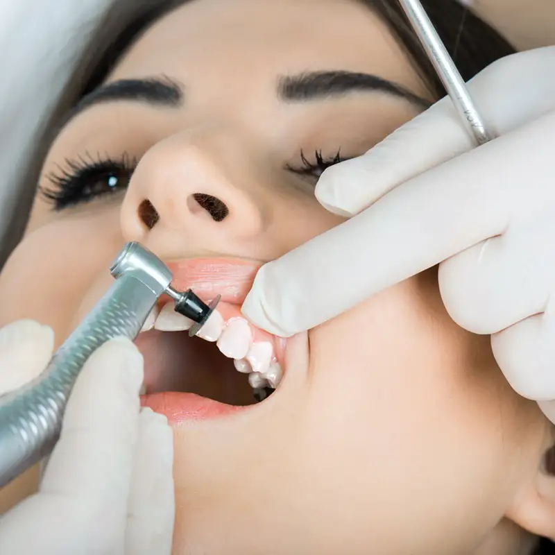 Professionelle Zahnreinigiung beim Zahnarzt Frankfurt