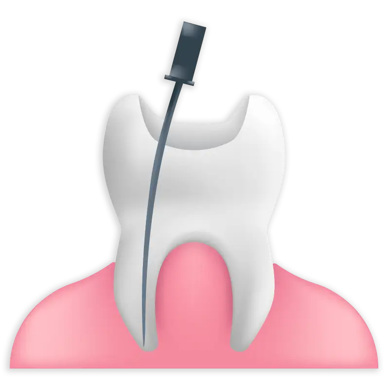 Icon Wurzelkanalbehandlung: Zahnarztpraxis DENTAL CORNER